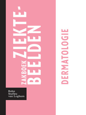 cover image of Zakboek ziektebeelden--Dermatologie